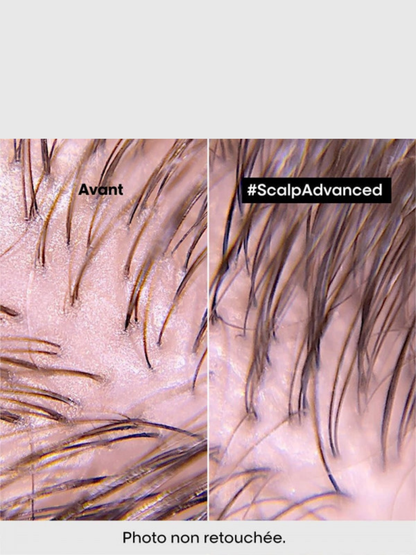 Argile 2 en 1 purifiante anti gras