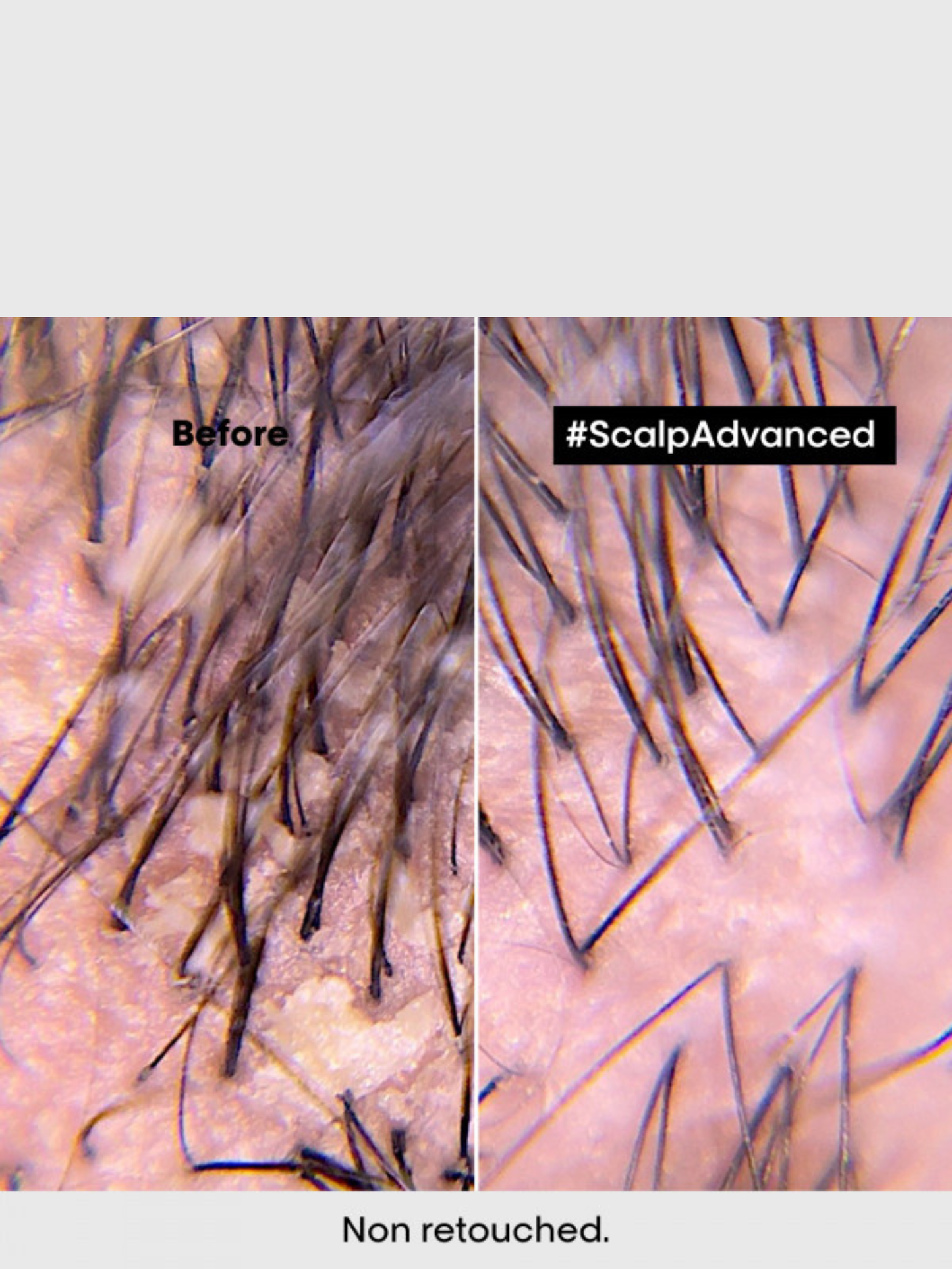 Shampoing dermo clarifiant anti pelliculaire