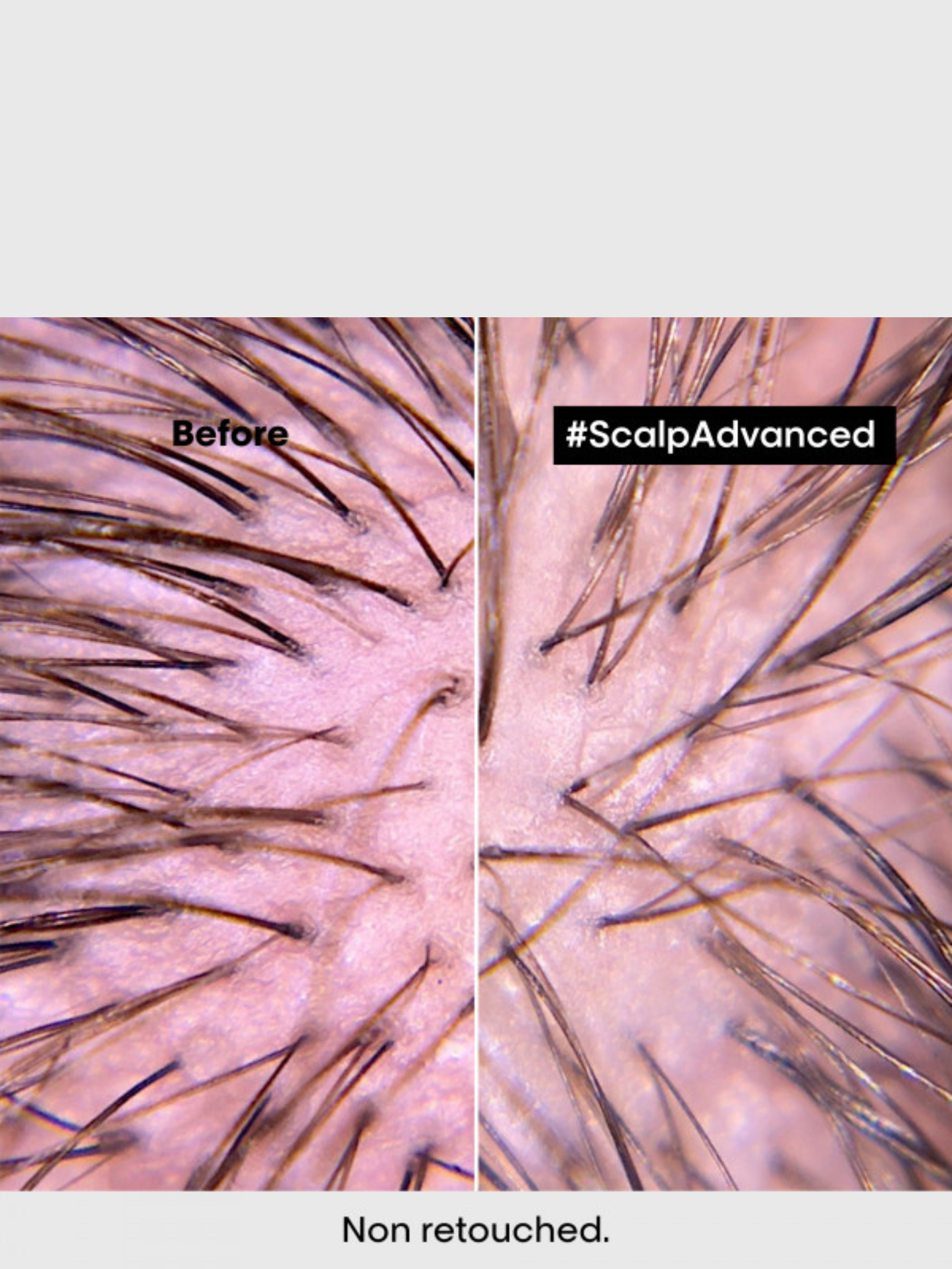 Traitement apaisant intense anti disconfort