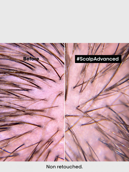 Traitement apaisant intense anti disconfort